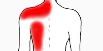 sol kürek kemiğinin altında arkadan ağrı