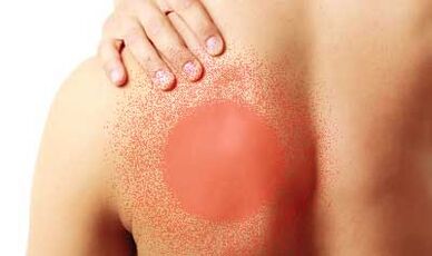 sol omuz bıçağının altında ağrı