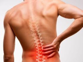 Osteokondroz nedeniyle bel ağrısı